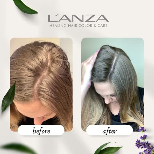 L'ANZA Healing Remedy Scalp Balancing Leave-in Treatment, Restores, Revives, and Nourish Hair & Scalp, Promotes Healthier Hair Growth, Thickness and Density (3.4 Fl Oz) – Image 4